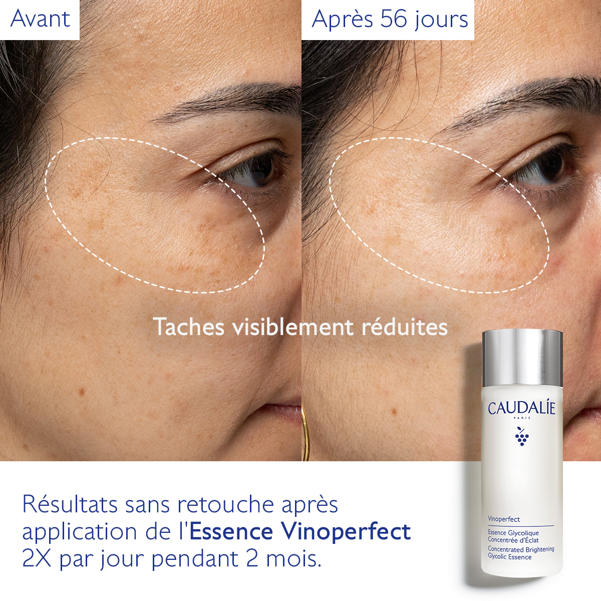 Caudalie Vinoperfect Essence Glycolique Concentrée d_Éclat — vue 7