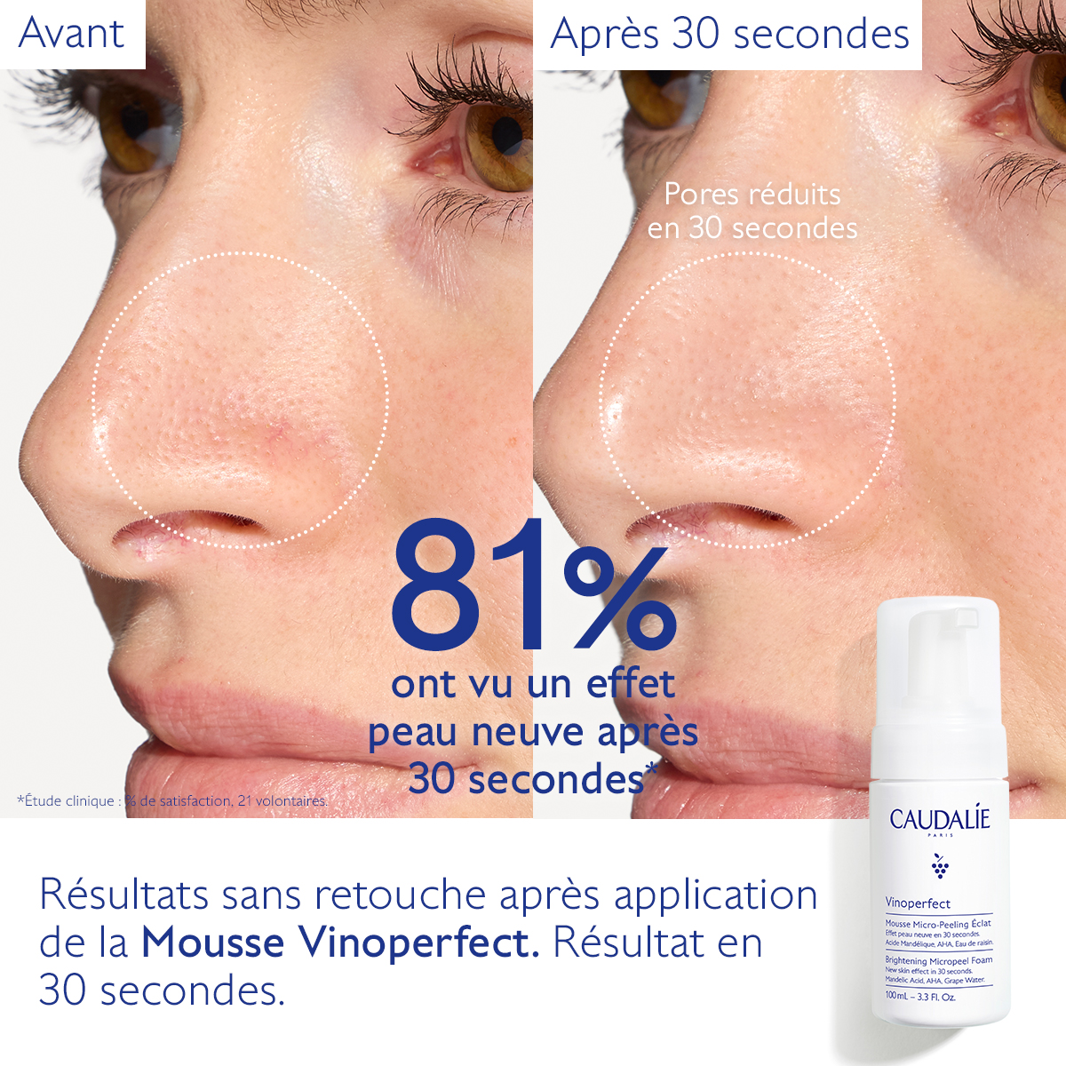 Caudalie Vinoperfect Mousse Micro-Peeling Éclat — vue 6