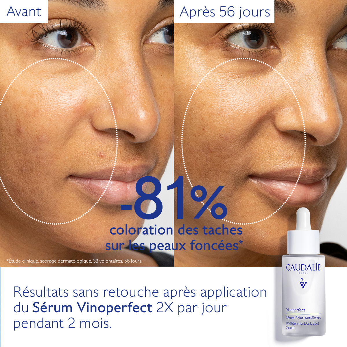 Caudalie Vinoperfect Sérum Éclat Anti-Taches — vue 12