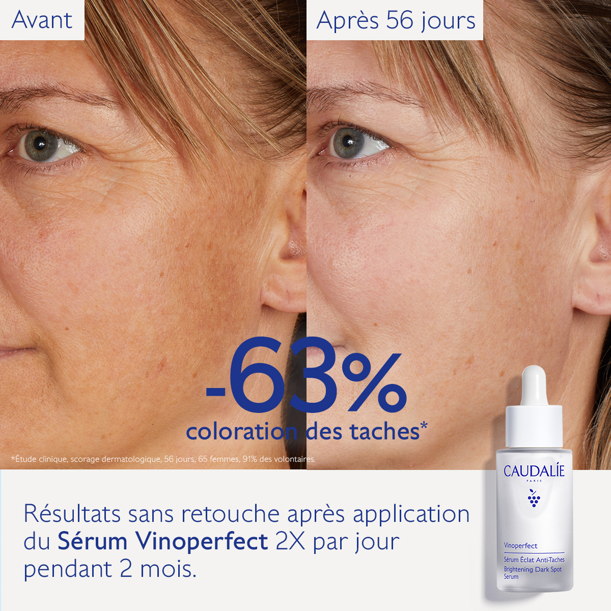 Caudalie Vinoperfect Sérum Éclat Anti-Taches — vue 11