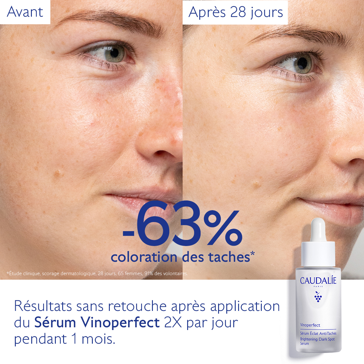 Caudalie Vinoperfect Sérum Éclat Anti-Taches — vue 13