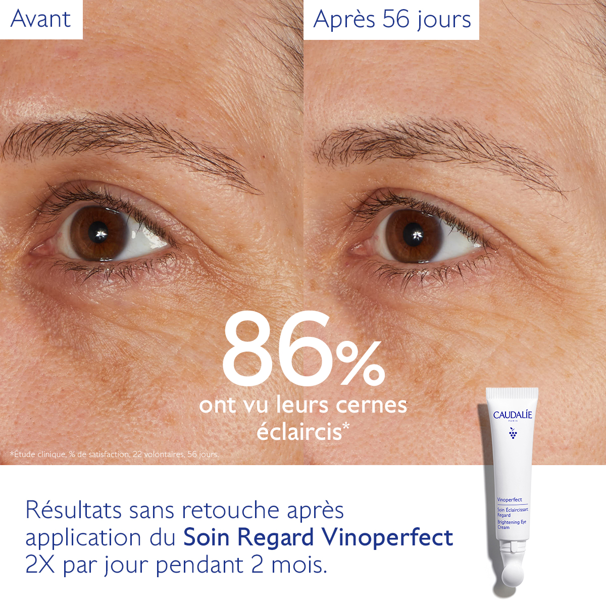 Caudalie Vinoperfect Soin Éclaircissant Regard — vue 7