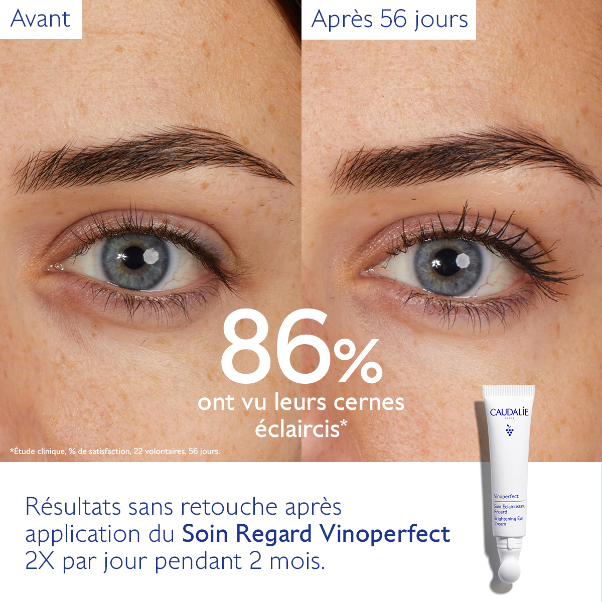 Caudalie Vinoperfect Soin Éclaircissant Regard — vue 6