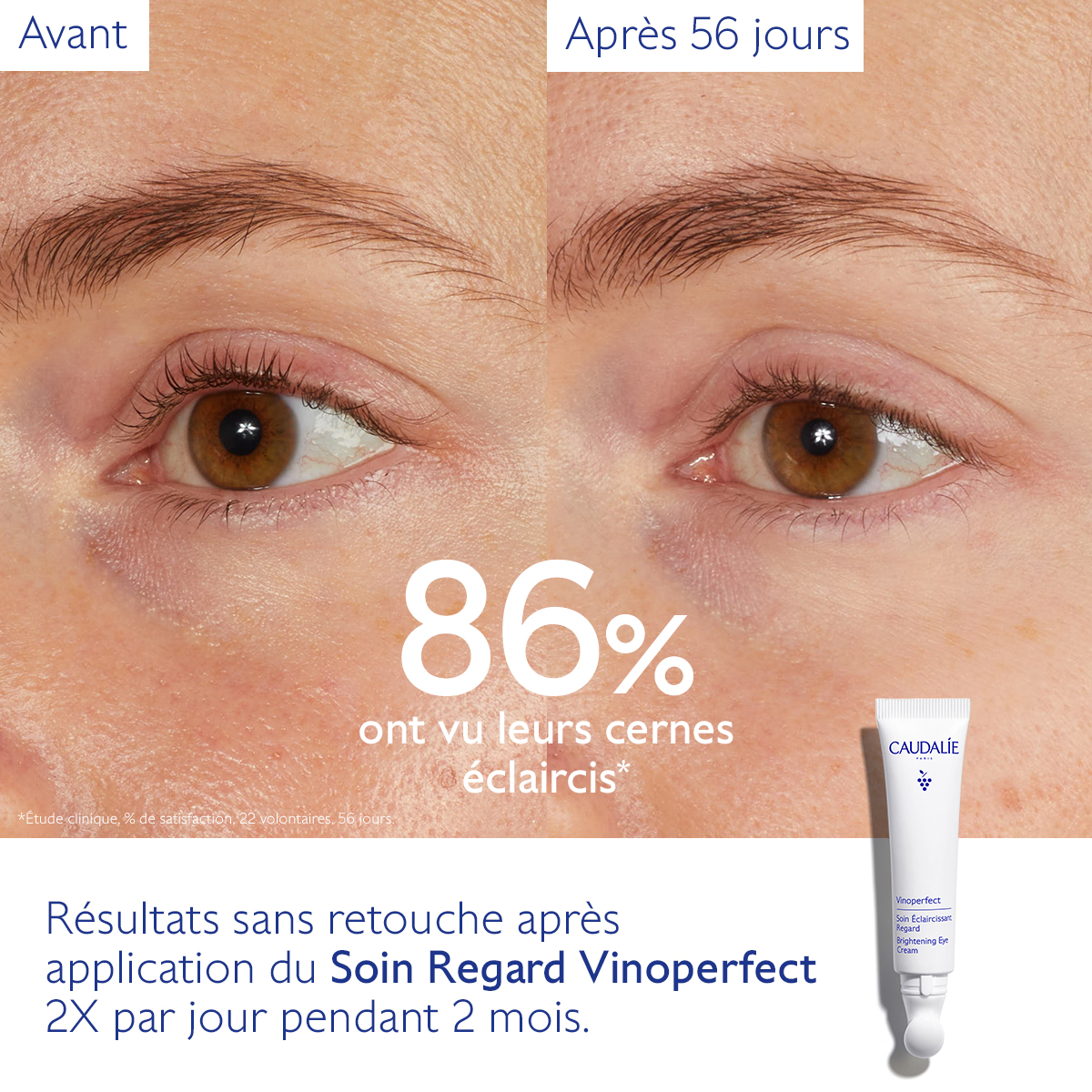 Caudalie Vinoperfect Soin Éclaircissant Regard — vue 8