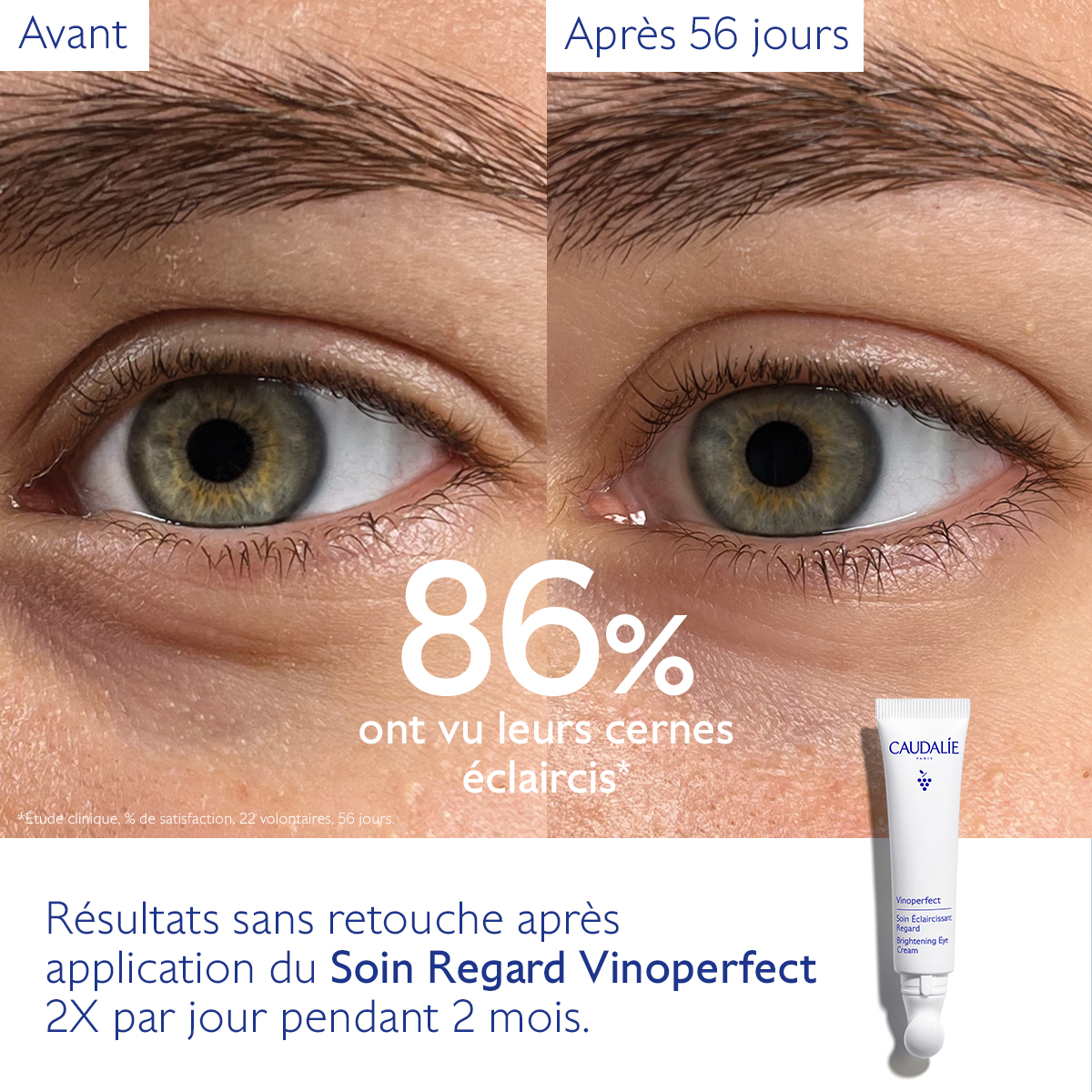 Caudalie Vinoperfect Soin Éclaircissant Regard — vue 5