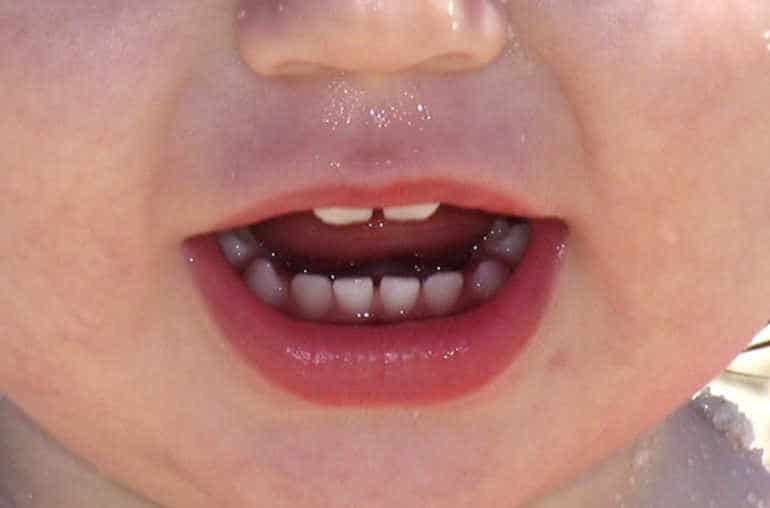 APHTABEBE solution anti aphte bebe